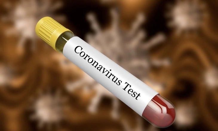 Се тестира потенцијална вакцина против коронавирусот