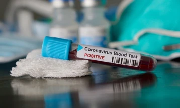 Прв смртен случај од коронавирус во Унгарија