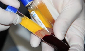 Во Пакистан оздраве првиот пациент од Ковид-19 лекуван со крвна плазма 