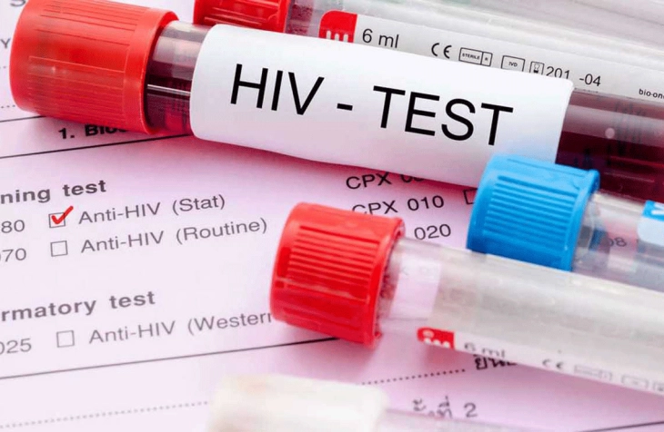ОН: Повеќе од половина милион заразени со ХИВ може да починат во субсахарска Африка поради кризата со Ковид-19