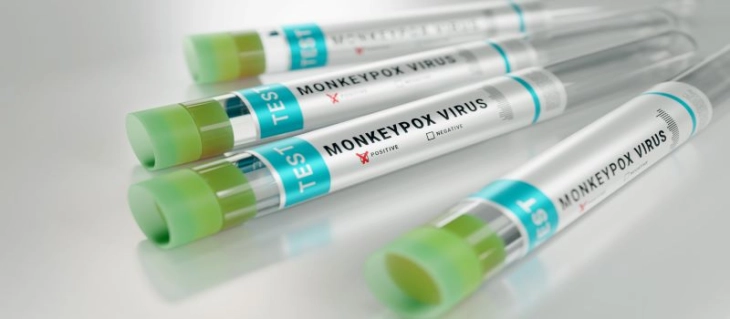 Мехмедовиќ: Пациентот од Кичево е тестиран за мајмунски сипаници, во моментов е во изолација