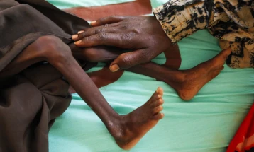 УНИЦЕФ: Околу 730 сомалиски деца годинава починаа од глад, заканата е екстремна