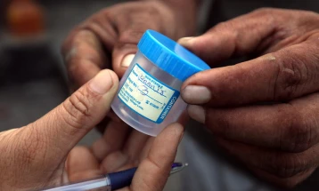СЗО: Првпат после неколку години, се зголемува бројот на заболени од туберкулоза