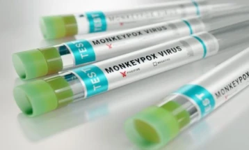 Public Health Institute analyzing whether Kichevo patient has monkeypox 