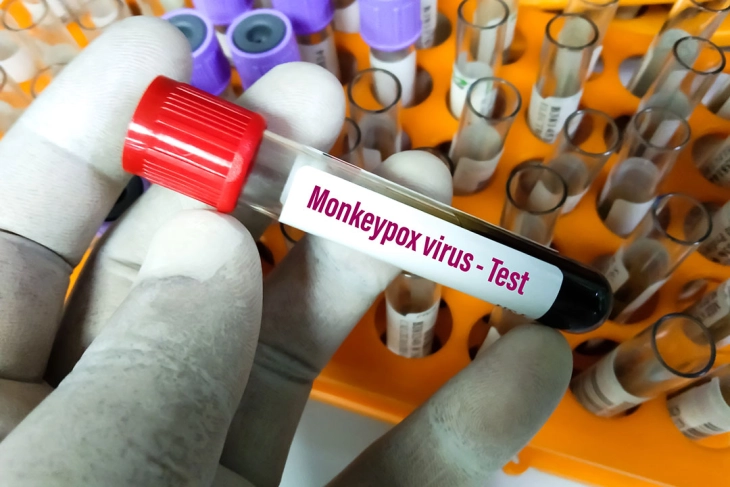Kichevo patient tests negative for monkeypox