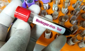 Kichevo patient tests negative for monkeypox