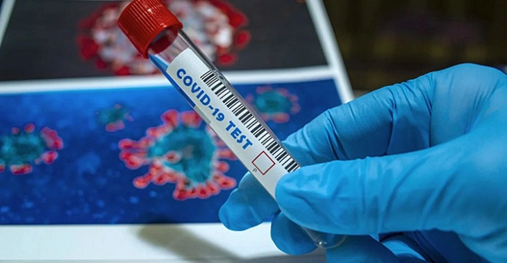 OBSH ftoi SHBA-në të ndajnë të dhëna për origjinën e koronavirusit