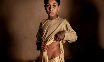 ОН: Во Авганистан сè уште јавно се камшикуваат луѓе