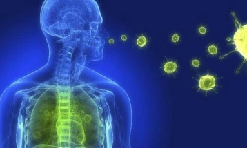 Во Полска починаа 14 лица како последица на легионерска болест