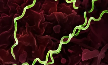 Пораст на случаите на сифилис во САД