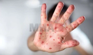 ISHP:  Gjithsej 903 persona me linë e dhenve në janar, një person 19-të vjeçar nga Kërçova me shyta infektive