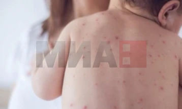 СЗО повика на вакцинација на децата против морбили