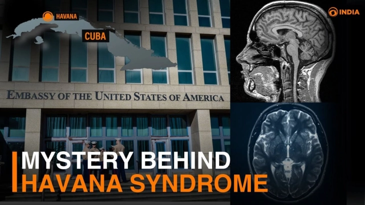 Западни медиуми: „Хавана синдромот“ е последица на напади од руското ГРУ