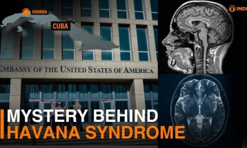 Западни медиуми: „Хавана синдромот“ е последица на напади од руското ГРУ
