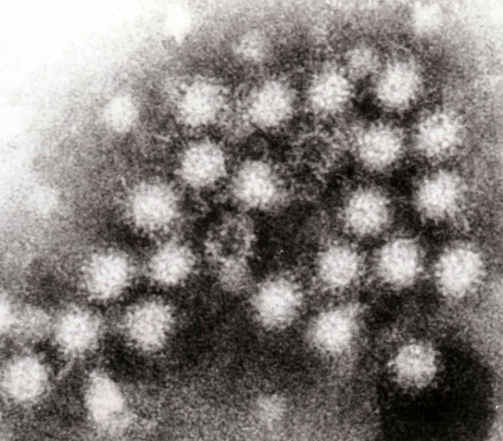Norovirus outbreak on Italy's Lake Garda