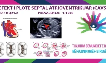 I njohim sëmundjet e rralla - DEFEKT I PLOTË SEPTAL ATRIOVENTRIKUAR (KAVSD)