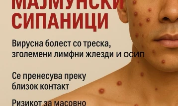 Мајмунски сипаници во Македонија - епидемиологот Даниловски вели дека не се пренесуваат лесно и мал е ризикот за епидемија