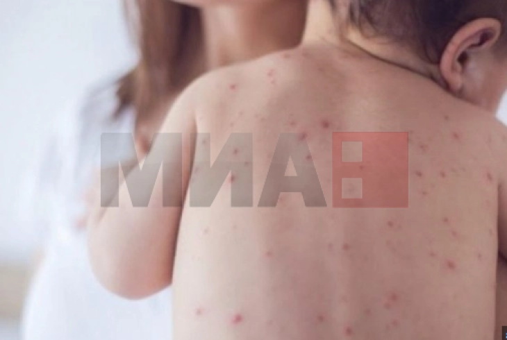 OBSH-ja dhe UNICEF-i: Rënia e shkallës së vaksinimit shkakton rritje të sëmundjeve të cilat mund të parandalohen