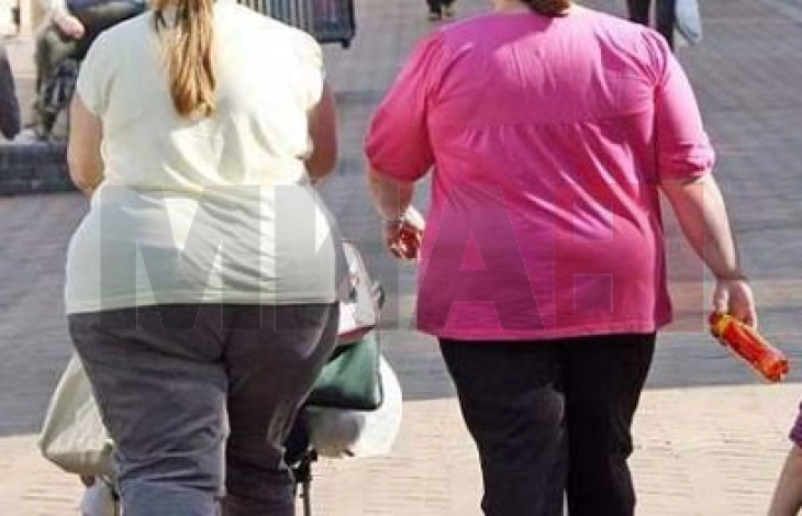 Светски ден на обезноста, лекарите предупредуваат дека се работи за комплексна хронична болест