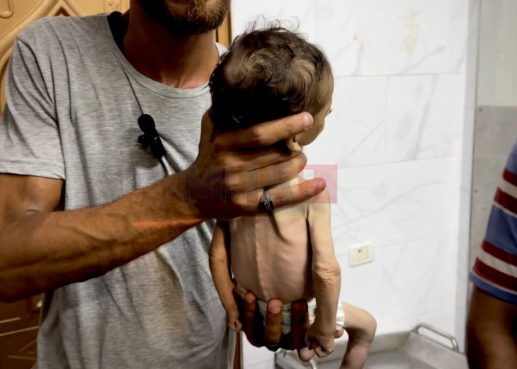 „Помошниот персонал  паѓа во несвест од глад“ додека гладот се шири во Газа и надежите за примирје избледуваат