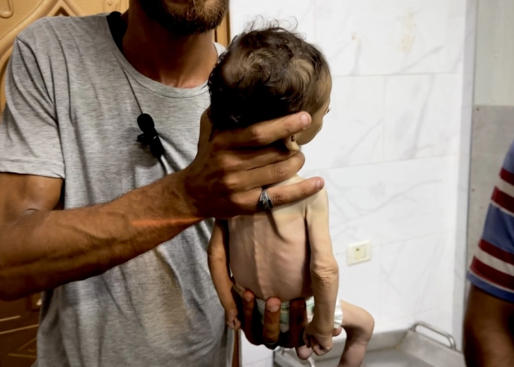 Italy, Croatia opening doors to children from Gaza