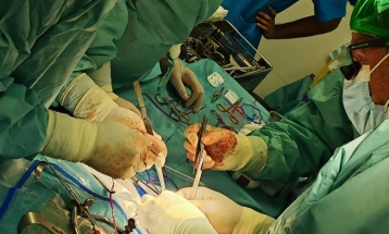 MSh: Edhe një transplantim të organeve nga një dhurues i ndjerë është kryer më 9 gusht