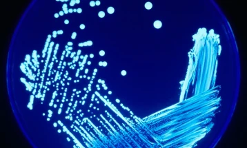 Четири смртни случаи од легионерска болест во Њујорк, изворот на бактеријата под контрола