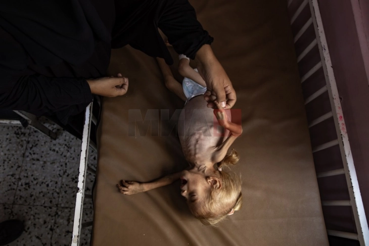 Guteresh: Uria në Rripin e Gazës është rezultat i veprimeve të qëllimshme të Izraelit