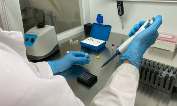 Јапонски научници пронашле третман за превенција од појава на Даунов синдром