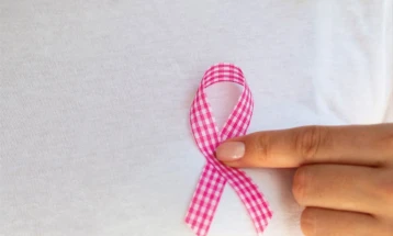 АФЖ Левица: Во Македонија не постои задолжителен и функционален национален скрининг за рак на дојка - апелираме за итно решавање на проблемот 