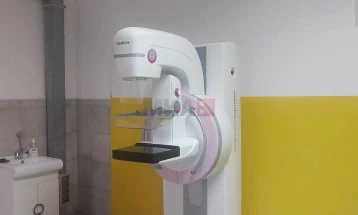 Раното откривање на рак на дојка спасува живот, порачуваат од кумановската болница