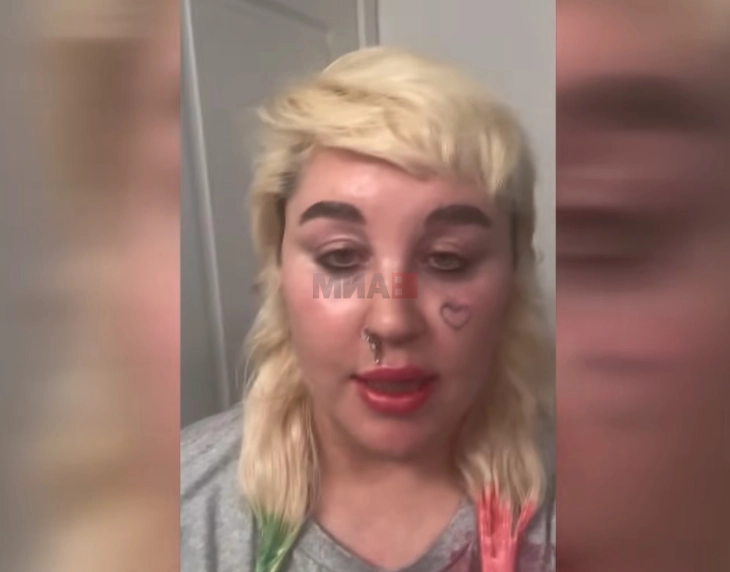 Аманда Бајнс: Земам „Оземпик“ за да бидам слаба и слатка