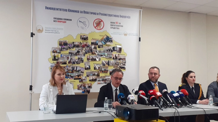 Aliu - Toshkovski: Qytetarët të mos përdorin mjete piroteknike, ato nuk janë lodër, pasojat janë serioze