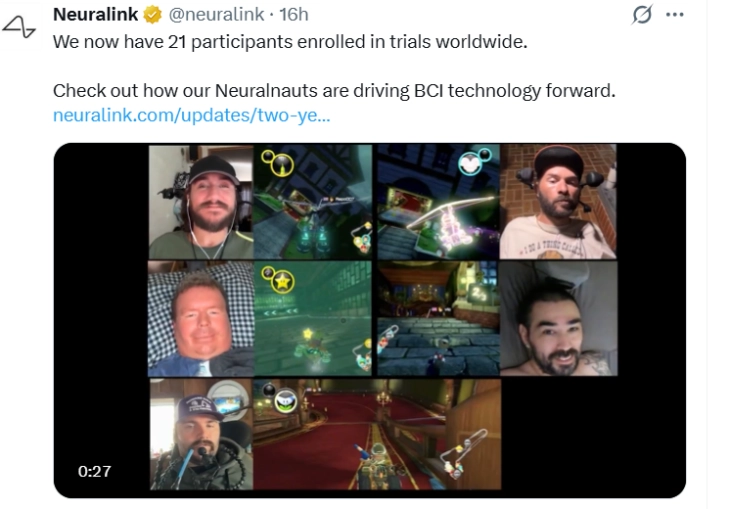 На парализиран човек во Британија му е вграден чип на Неуралинк во мозок: Само ќе помислам и тоа се случува