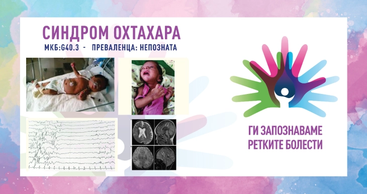 Ги запознаваме ретките болести: синдром Охтахара