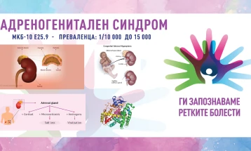 „Ги запознаваме ретките болести“: Конгенитална адренална хиперплазија