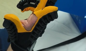 Донација за ЈЗУ Општа болница Кочани од 90 комплети ракавици за пасивна рехабилитација