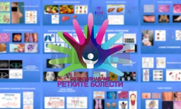 Promovimi i pullës postare për Ditën e ndërgjegjësimit për sëmundjet e rralla - AMS