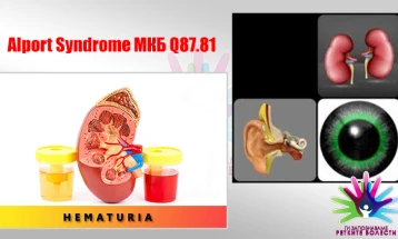 Ретки бубрежни болести: Алпортов синдром