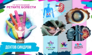 Ретки бубрежни болести: Дентов синдром