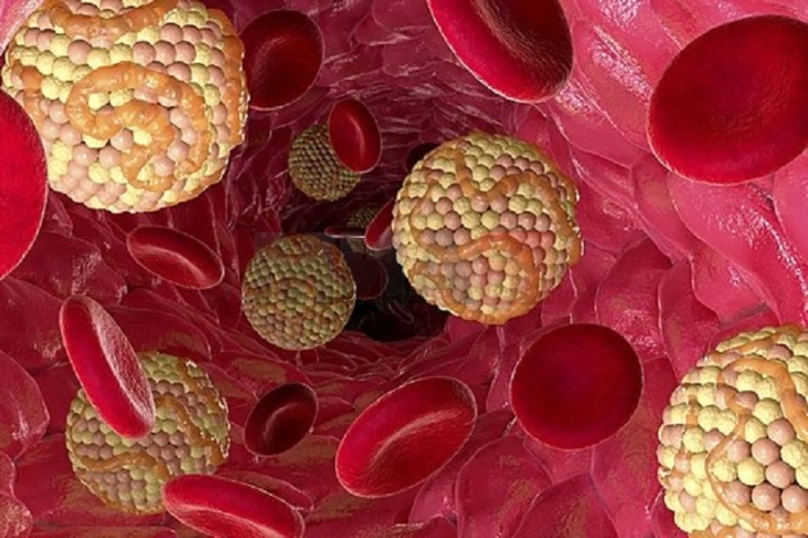 Лекарски совети: Потребни се најмалку шест месеци за значително подобрување на липидниот статус